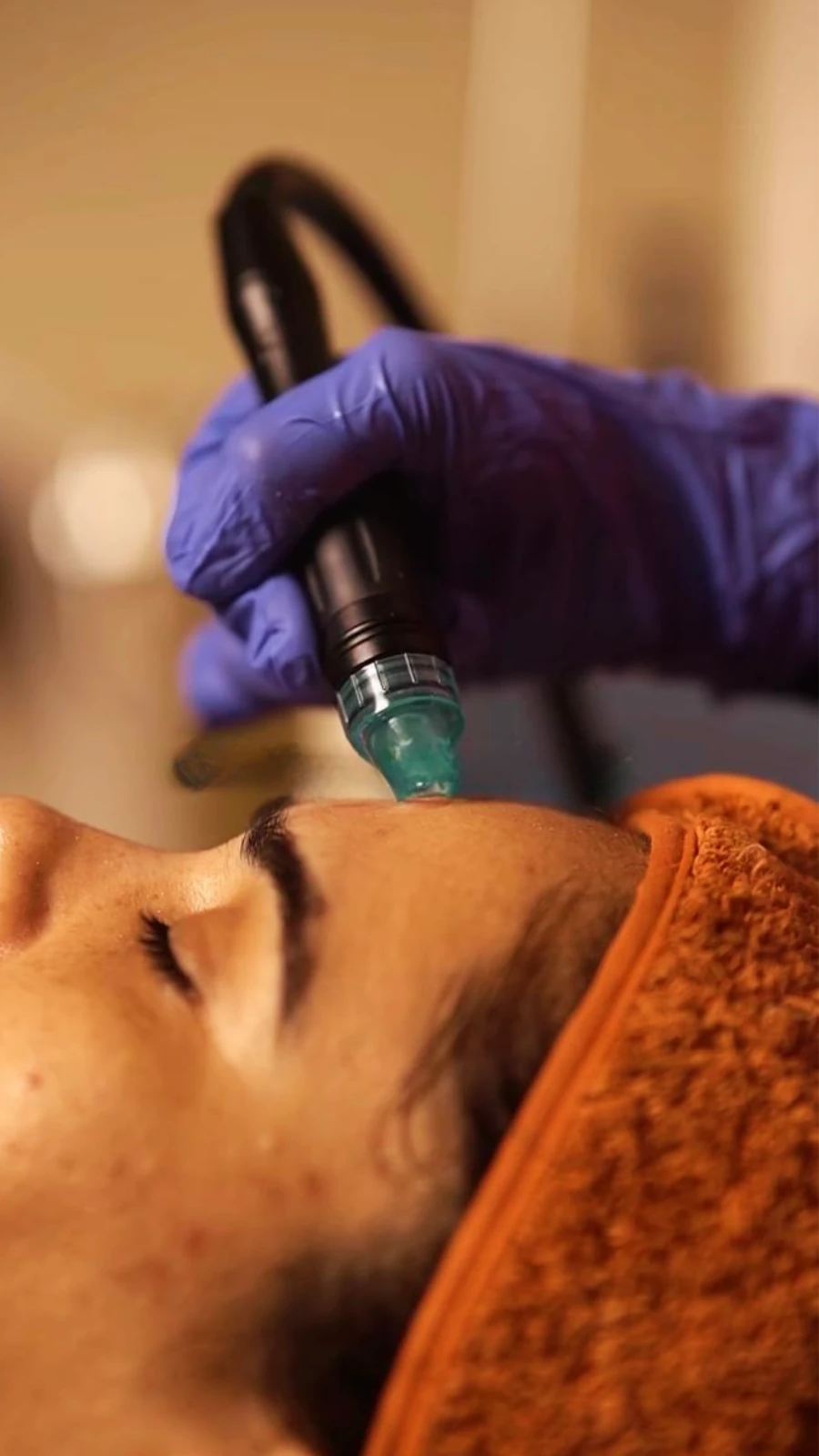 HydraFacial
